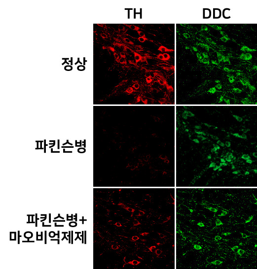 도파민 신경세포 잠들면 파킨슨병 유발