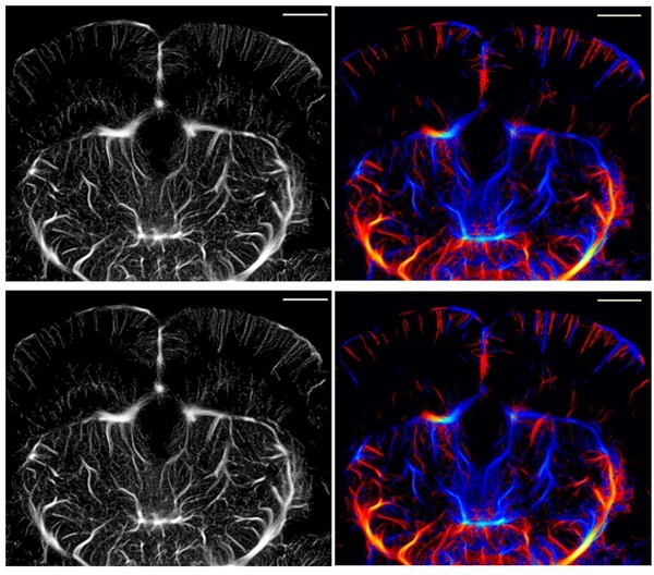 기존 ULM으로 획득한 쥐 뇌 모세혈관 영상(위)과 개발된 ULM-Lite 기법으로 획득한 모세혈관 영상(사진 제공=DGIST)