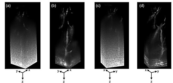 인체 간 영상에서의 생체 내 성능. 개발된 영상 기술 기반 RCA 트랜스듀서를 이용해 취득한 사람의 신장–비장영역 실시간 혈관 영상. (a, c) 기존 기법, (b, d) 제안 기법(사진 제공=DGIST)