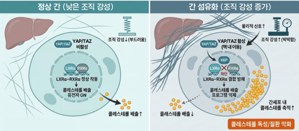 딱딱해진 간이 병을 키운다… 서울대, 간 섬유화로 인한 대사 교란 원리 규명